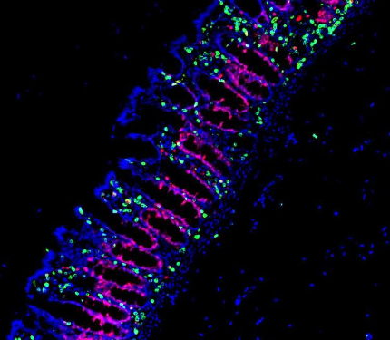 A digital rendering of glowing cells in bone marrow.